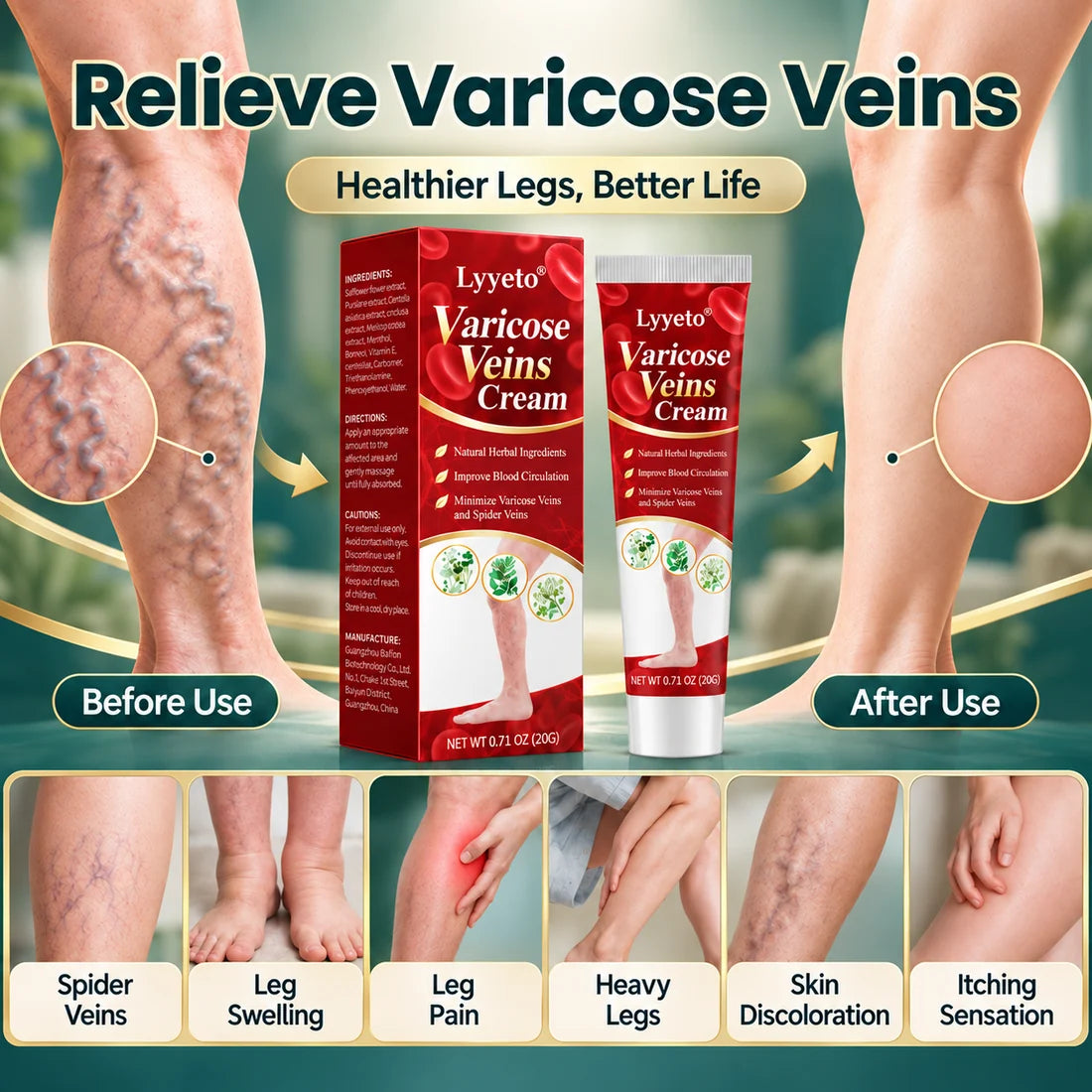 Lyyeto® Varicose Veins Cream