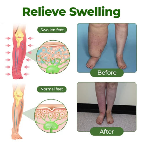 Lyyeto® Professional Leg Circulation Cream